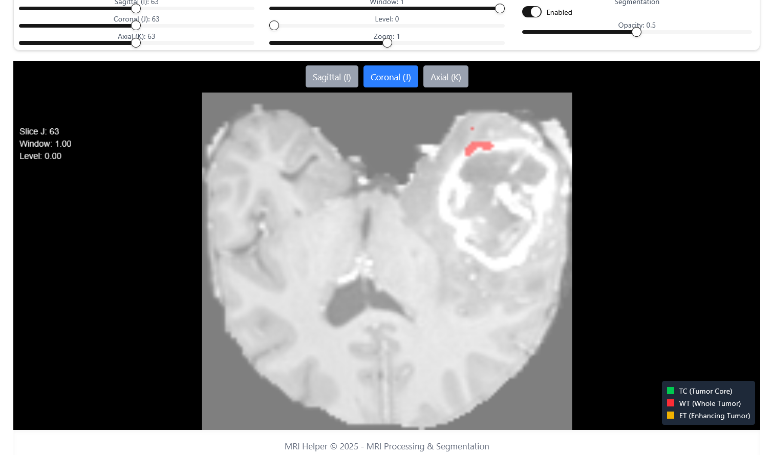 MRI Image helper