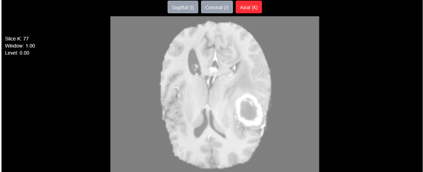 MRI Image helper